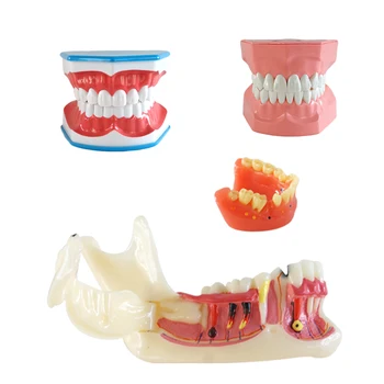 Dental Dentes Modelo Dental Modelo de Ensino Dentes Escovar Modelo com a Língua Materiais Dentários